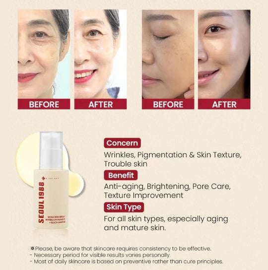 SEOUL 1988 Serum Retinal Liposome 2% + Black Ginseng